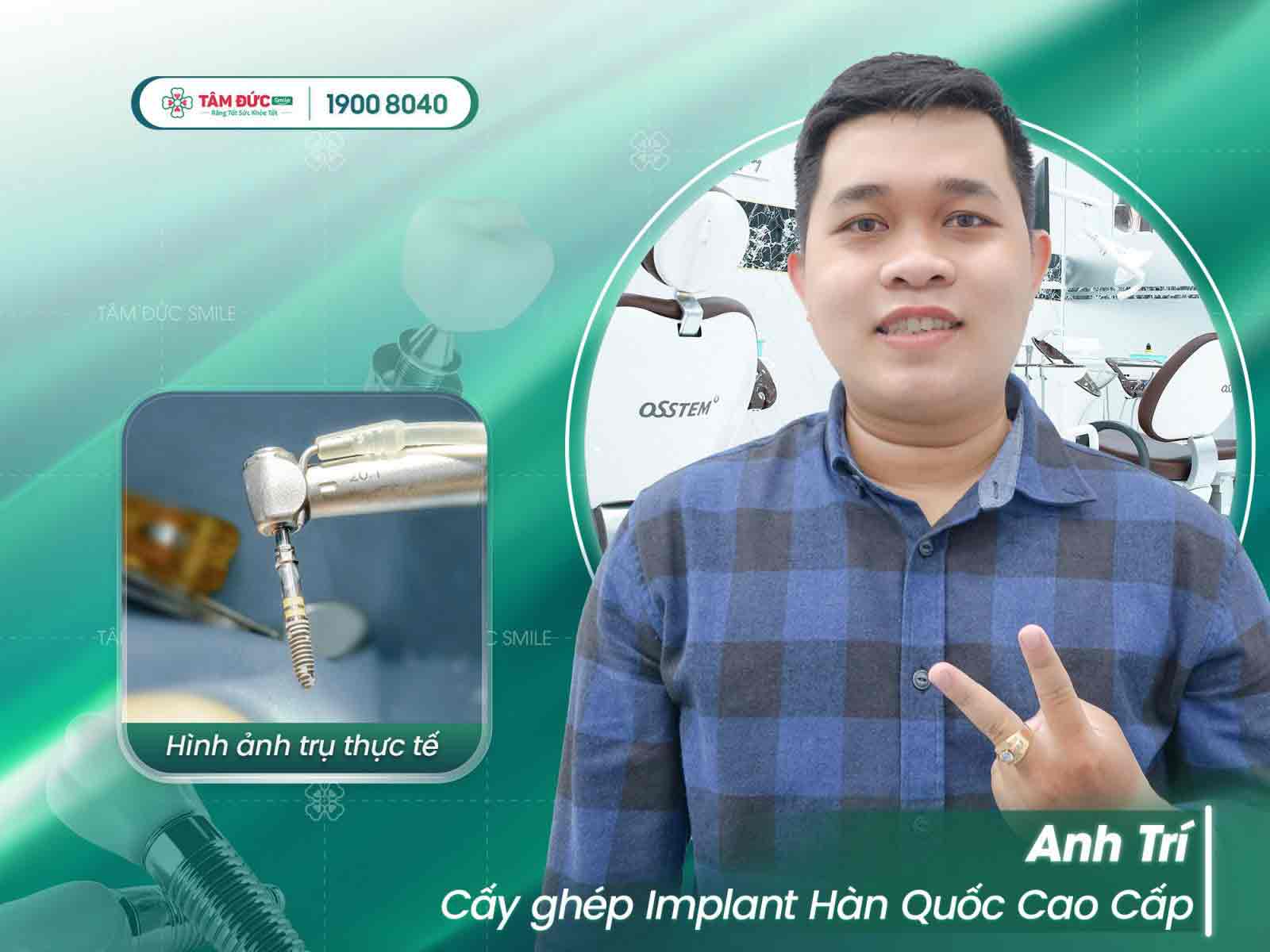 anh trí sau khi trồng răng tại tâm đức smile