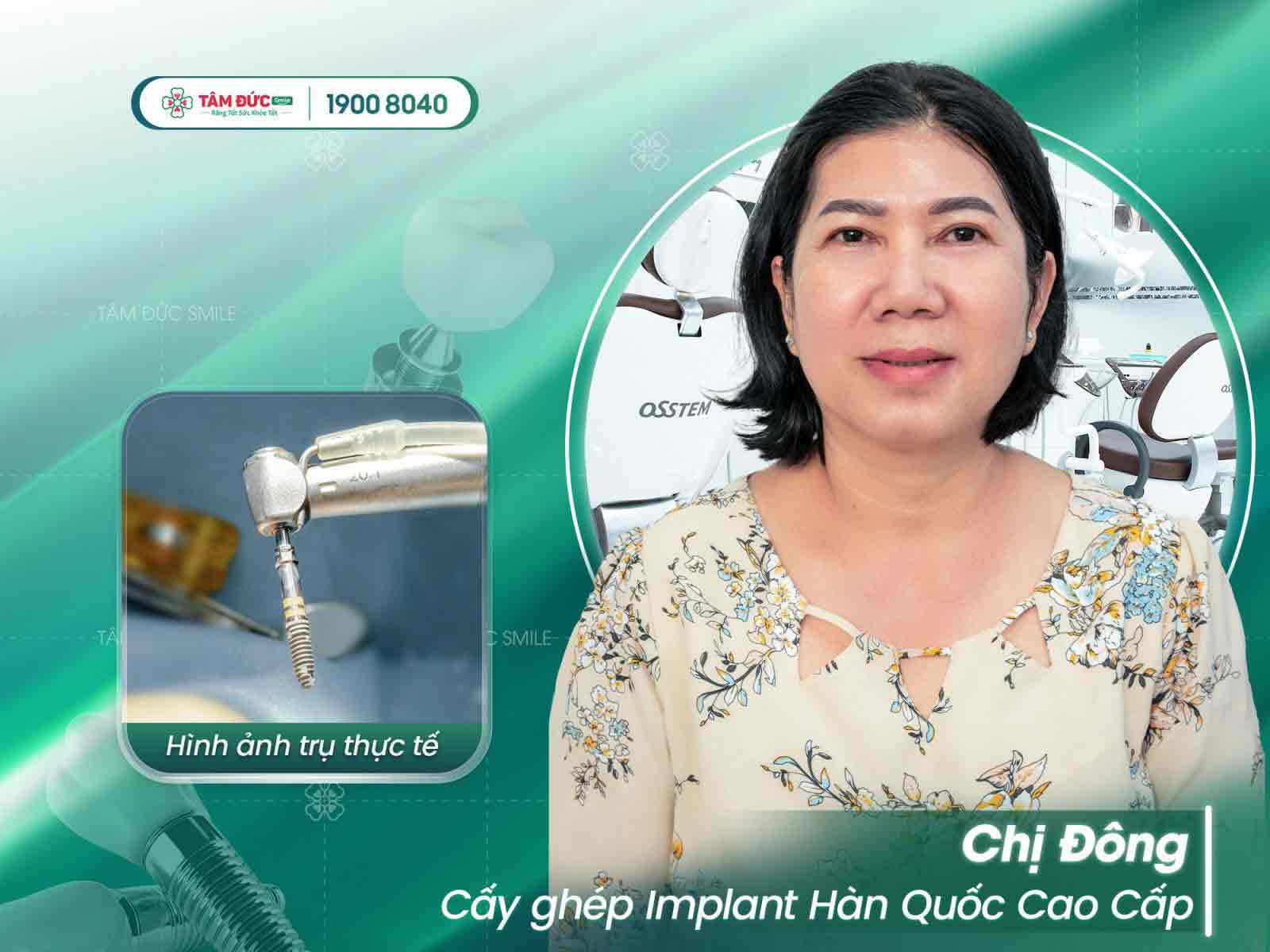 chị đông sau khi trồng răng tại tâm đức smile